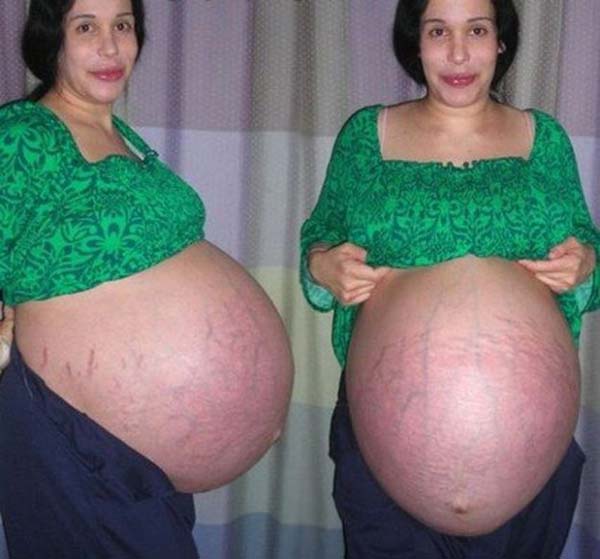 Как изглежда днес жената, която през 2009 роди осемзнаци, имайки вече 6 деца