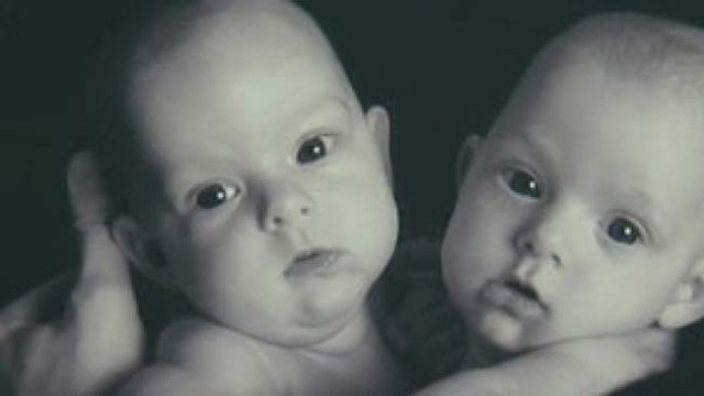 Преди 14 години хирурзи разделили тези сиамски близначки. Ето как живеят днес: