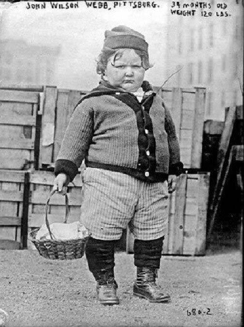 Исторически-снимки-на-момчето,-което-на-2-години-тежало-55-кг