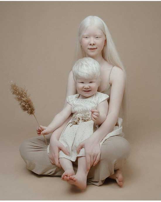 албиноси