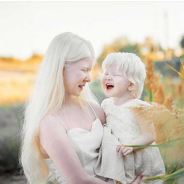 сестри-албиноси
