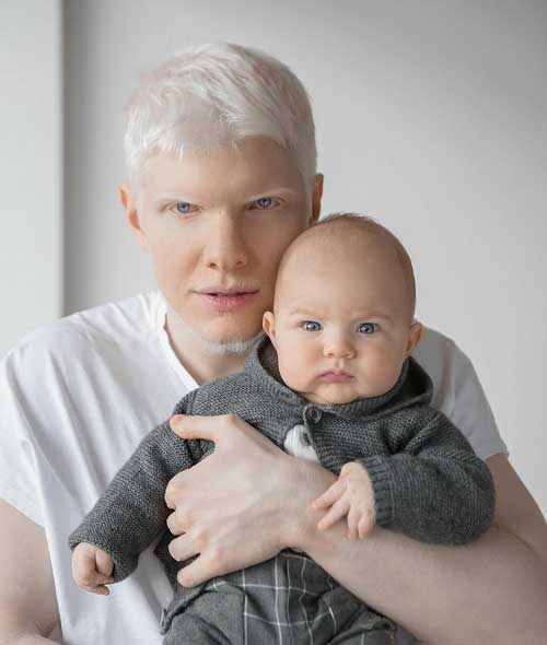 мъж-албинос-с-бебе
