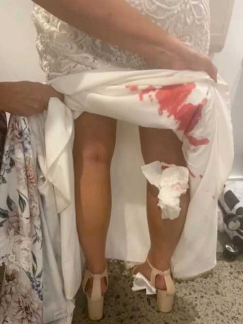 сватбена-рокля-кръв