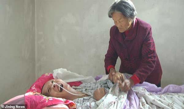 В Китай мъж прекарал 12 години в кома, като през
