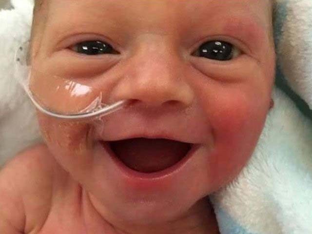 Усмивката-на-това-недоносено-бебе-дарява-надежда-на-хиляди-хора-по-света