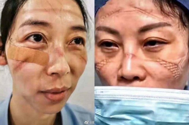 Как изглеждат лицата на китайските лекари в края на смяната