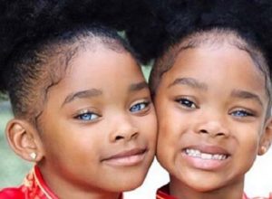 Сестри-близначки покориха интернет с невероятната си външност