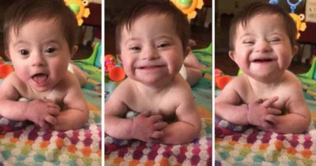 Бебе със синдром на Даун си спечели милиони фенове, показвайки своята усмивка