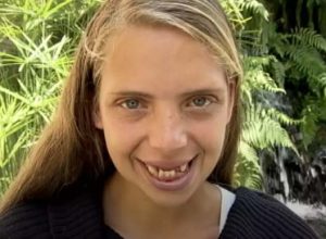 Момиче забременяло на 17 и й изпадали зъбите. След 7 години стилисти и зъболекари я променили!