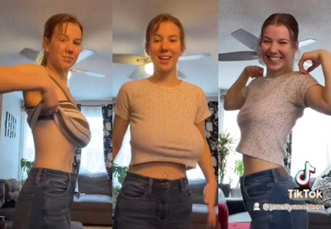 20 годишната Джанел Нелсън наскоро отпразнувала намаляването на размера на гърдите