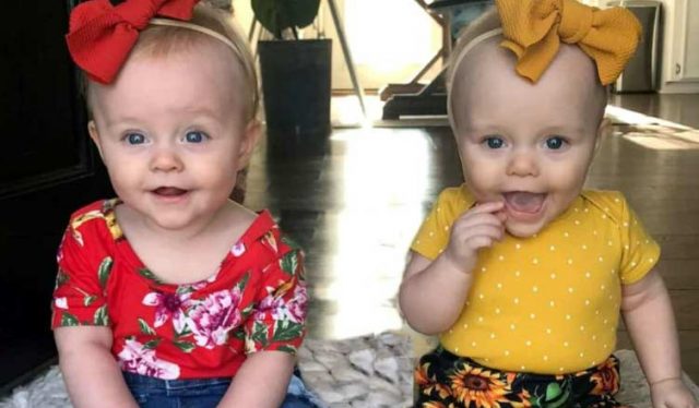 Чудо! Eдна от близначките спасила живота на сестра си още в утробата