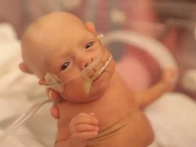 Той се родил недоносен 12 седмици по-рано. Вижте го само как изглежда след 8 години: