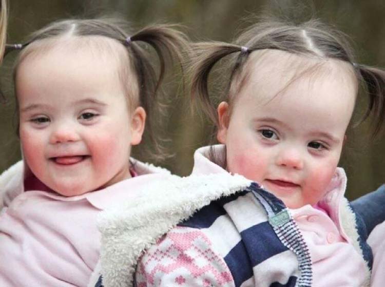 Двойката така се радвала на новородените си близнаци. Но лекарят им казал нещо притеснително