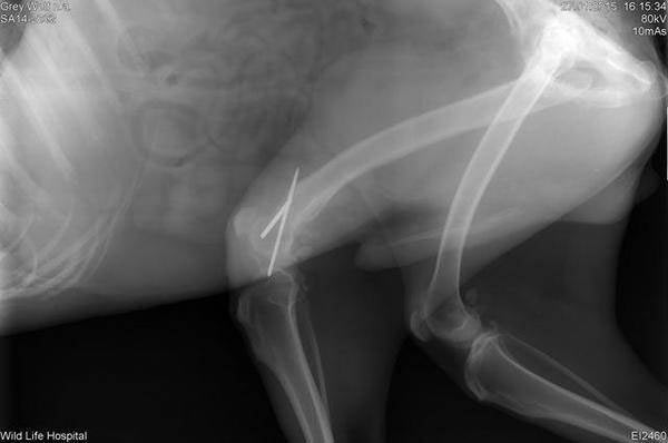 рентгенова снимка на счупен крак 