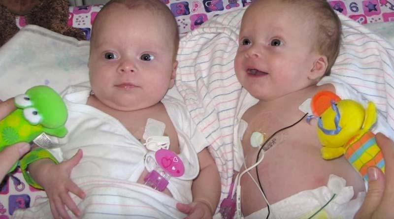 бебета близначки
